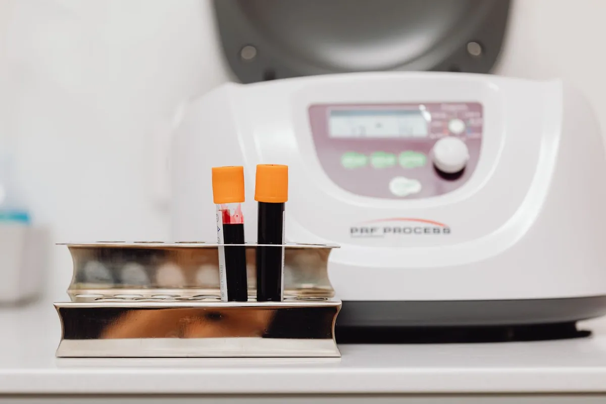Preparing your plasma (PRP)